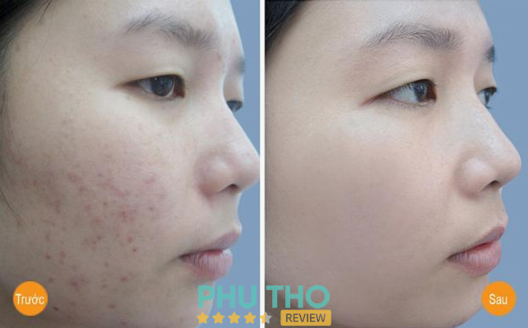 Trà Spa Beauty & Academy Phú Thọ